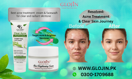 Best Acne Treatment Cream in Pakistan